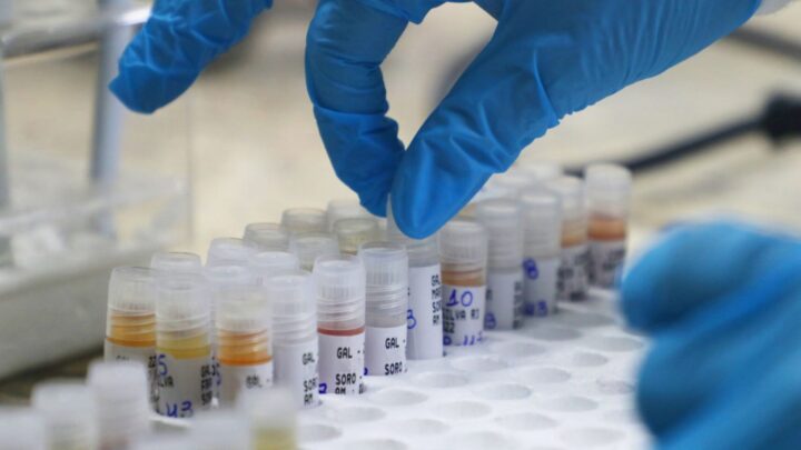 Mpox: Informe semanal atualiza situação da doença no Amazonas, nesta terça-feira